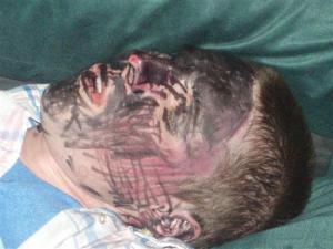 "What's the big deal?"