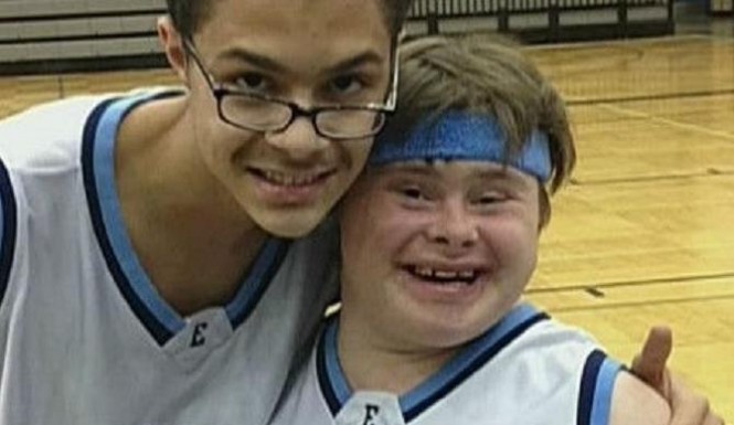 Michael-Kelley-Down-Syndrome