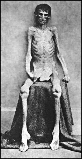 Andersonville_survivor