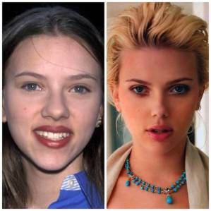 But it worked for Scarlet!