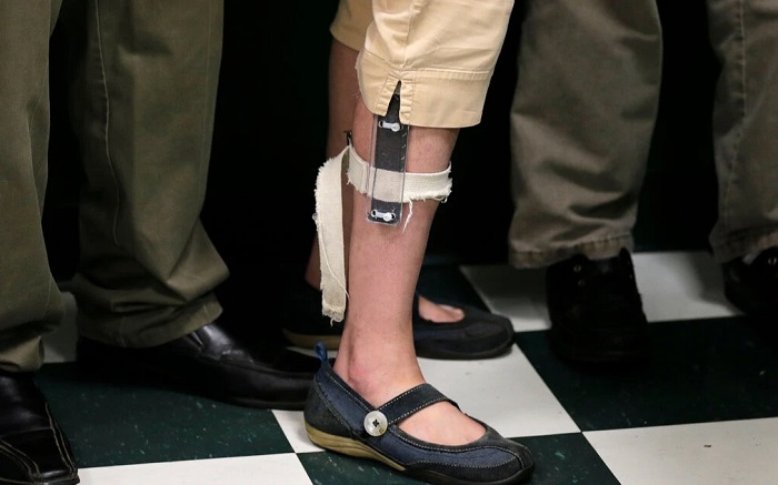 15electricshock-3-jumbo